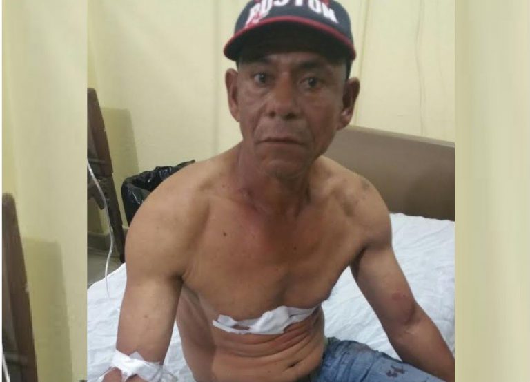 Siete heridos durante un atraco en el que se llevaron 700 mil pesos y una camioneta