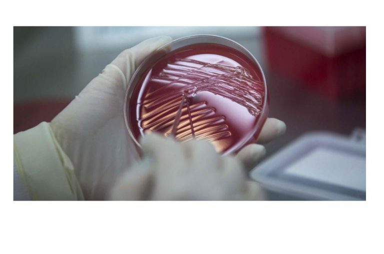 Microbacterias fecales logran controlar la diabetes en pruebas animales