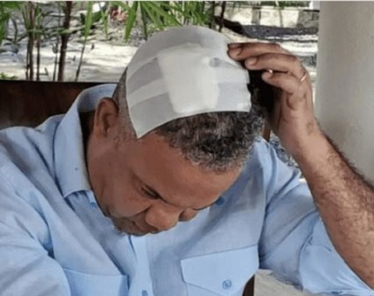 Héctor Acosta aclara incidente ocurrido en recorrido del Presidente Abinader donde resultó con golpe en la cabeza